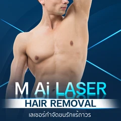 เลเซอร์ AI กำจัดขนรักแร้ 1 ครั้ง (ผู้ชายเท่านั้น)