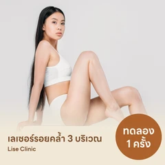 โปรแกรมรักษารอยคล้ำด้วยเลเซอร์ Q-Switch เลือก 3 บริเวณ