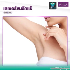 เลเซอร์ Dynamic Tech กำจัดขนรักแร้ 1 ครั้ง (ราคาทดลอง)