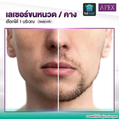 เลเซอร์ Dynamic Tech กำจัดขนหนวดหรือคาง 1 ครั้ง (ราคาทดลอง)