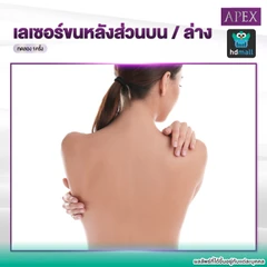 เลเซอร์ Dynamic Tech กำจัดขน (เลือก 1 จุด หลังบน/หลังล่าง) 1 ครั้ง (ราคาทดลอง)