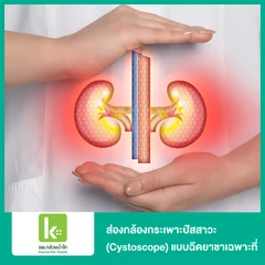 ส่องกล้องกระเพาะปัสสาวะ (Cystoscope) แบบฉีดยาชาเฉพาะที่
