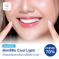 โปรแกรมฟอกสีฟันด้วยระบบ Cool Light พร้อมดูแลช่องปาก 4 รายการ