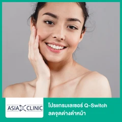 โปรแกรมเลเซอร์ Q-Switch ลดจุดด่างดำหน้า