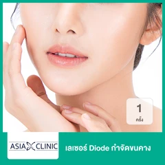 เลเซอร์ Diode กำจัดขนคาง 1 ครั้ง