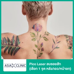 Pico Laser ลบรอยสัก ขนาด 20-30 ตร.ซม (เลือก 1 จุด หลัง/เอว/หน้าอก)