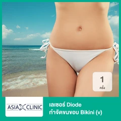 เลเซอร์ Diode กำจัดขนขอบ Bikini (v) 1 ครั้ง