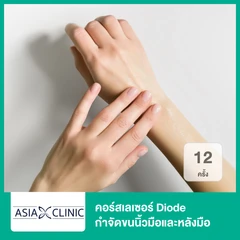 คอร์สเลเซอร์ Diode กำจัดขนนิ้วมือและหลังมือ 12 ครั้ง
