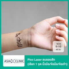 Pico Laser ลบรอยสัก ขนาด 5-10 ตร.ซม (เลือก 1 จุด นิ้วมือ/ข้อมือ/ข้อเท้า)