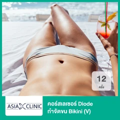 คอร์สเลเซอร์ Diode กำจัดขน Bikini (V) 12 ครั้ง