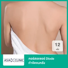 คอร์สเลเซอร์ Diode กำจัดขนหลัง 12 ครั้ง