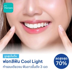 ฟอกสีฟันที่คลินิก ด้วยระบบ Cool Light