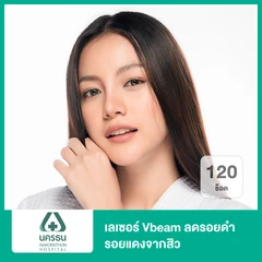 เลเซอร์ Vbeam ลดรอยดำ รอยแดงจากสิว 120 ช็อต