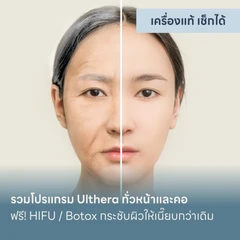 รวมโปรแกรม Ulthera ทั่วหน้าและคอ การันตีเครื่องแท้ หมอดูแลเองทุกเคส