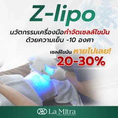 โปรแกรม Z Lipo สลายไขมันด้วยความเย็น CoolSculpting 1 จุด