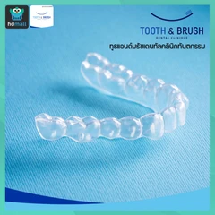 ทำรีเทนเนอร์แบบใส 1 ชิ้น ฟันบนหรือล่าง