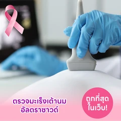 ตรวจคัดกรองมะเร็งเต้านมด้วยวิธีอัลตราซาวด์