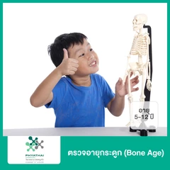 ตรวจอายุกระดูก (Bone Age) (เด็ก 5-12 ปี)