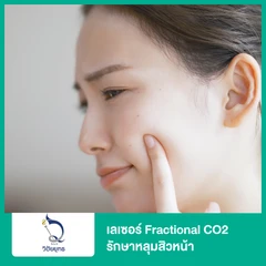 เลเซอร์ Fractional CO2 รักษาหลุมสิวหน้า