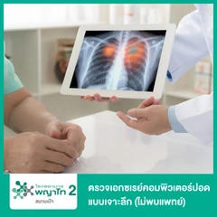 ตรวจเอกซเรย์คอมพิวเตอร์ปอดแบบเจาะลึก (ไม่พบแพทย์)