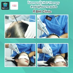 โปรแกรมเมโส Hair Therapy สำหรับผู้ที่ผมบาง ผมร่วง
