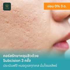 คอร์สรักษาหลุมสิวด้วย Subcision 3 ครั้ง