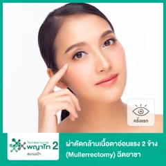 ผ่าตัดกล้ามเนื้อตาอ่อนแรง 2 ข้าง (Mullerrectomy) ฉีดยาชา (ครั้งแรก)