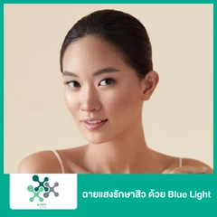 ฉายแสงรักษาสิว ด้วย Blue Light