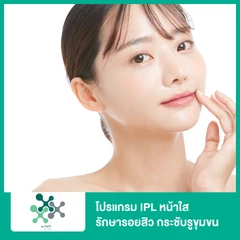 โปรแกรม IPL หน้าใส รักษารอยสิว กระชับรูขุมขน