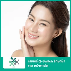 เลเซอร์ Q-Switch รักษาฝ้า กระ หน้าขาวใส