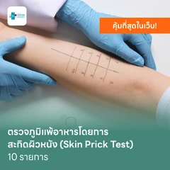 ตรวจหาสารก่อภูมิแพ้อาหาร 10 รายการ โดยการสะกิดผิวหนัง