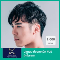 ปลูกผม ด้วยเทคนิค FUE 1,000 กราฟต์ (ครั้งแรก)