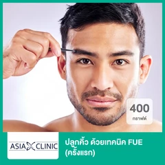 ปลูกคิ้ว ด้วยเทคนิค FUE 400 กราฟต์ (ครั้งแรก)