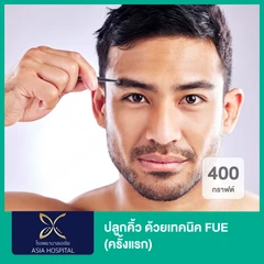 ปลูกคิ้ว ด้วยเทคนิค FUE 400 กราฟต์ (ครั้งแรก)