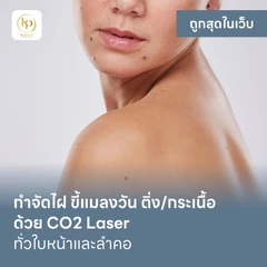 กำจัดไฝ ขี้แมลงวัน ติ่งเนื้อ กระเนื้อ ด้วย CO2 Laser ขนาดเส้นผ่านศูนย์กลางไม่เกิน 2 มม. ไม่จำกัดจุดทั่วใบหน้าและลำคอ