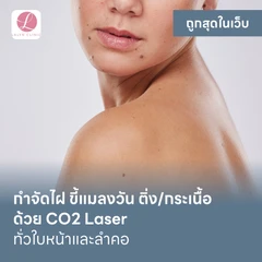 กำจัดไฝ ขี้แมลงวัน ติ่งเนื้อ กระเนื้อ ด้วย CO2 Laser ขนาดเส้นผ่านศูนย์กลางไม่เกิน 2 มม. ไม่จำกัดจุดทั่วใบหน้าและลำคอ 1 ครั้ง