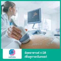 อัลตราซาวด์ 4 มิติ เพื่อดูทารกในครรภ์