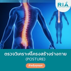 ตรวจวิเคราะห์โครงสร้างร่างกาย (Posture)