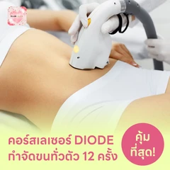 คอร์สเลเซอร์กำจัดขนทั่วร่างกาย 12 ครั้ง ด้วย Diode Laser