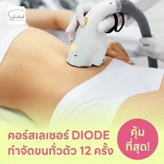 คอร์สเลเซอร์กำจัดขนทั่วร่างกาย 12 ครั้ง ด้วย Diode Laser