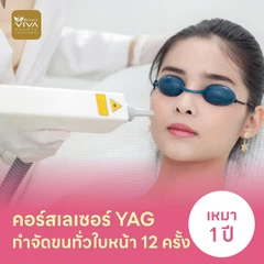 คอร์สเลเซอร์กำจัดขนทั่วหน้า 12 ครั้ง ด้วย YAG Laser