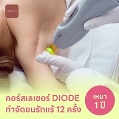 คอร์สเลเซอร์กำจัดขนรักแร้ 12 ครั้ง ด้วย Diode Laser