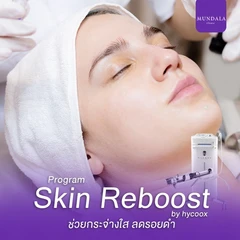 โปรแกรมเมโสหน้า Skin Reborn ผิวขาวใส ลดรอย 3 ซีซี