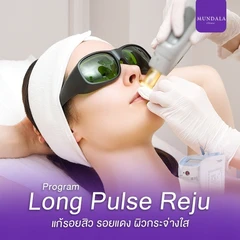 เลเซอร์ Long Pulse Reju หน้า แก้รอยสิว (จำนวนช็อตขึ้นอยู่กับแพทย์ประเมิน)