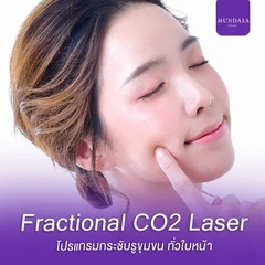 เลเซอร์ Fractional CO2 กระชับรูขุมขนหน้า