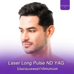 เลเซอร์ Long Pulse Nd:YAG กำจัดขนหนวด 1 ครั้ง