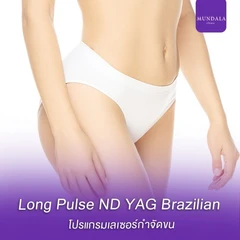 เลเซอร์ Long Pulse Nd:YAG กำจัดขน Brazilian (VI) 1 ครั้ง