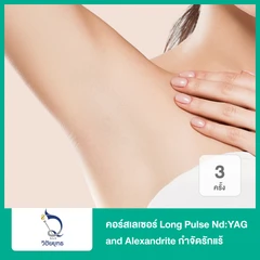 คอร์สเลเซอร์ Long Pulse Nd:YAG and Alexandrite กำจัดขนรักแร้ 3 ครั้ง