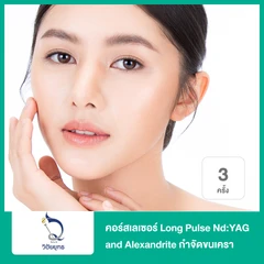 คอร์สเลเซอร์ Long Pulse Nd:YAG and Alexandrite กำจัดขนเครา 3 ครั้ง