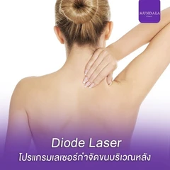 เลเซอร์ Diode กำจัดขนหลัง 1 ครั้ง